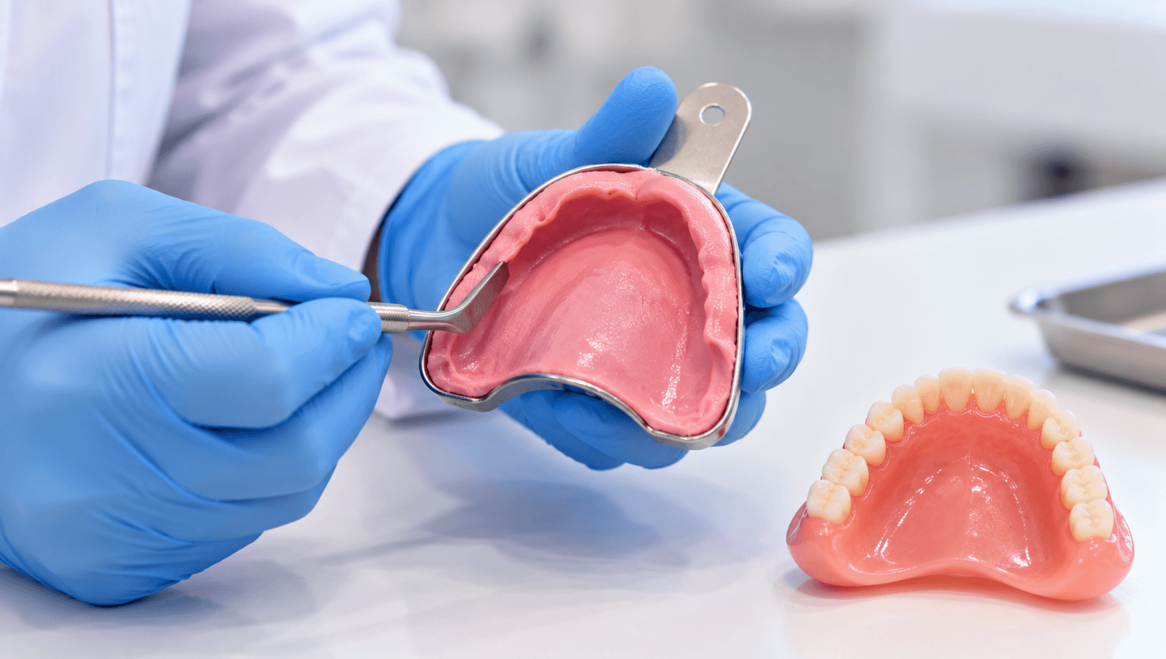 Complete Denture Impressions: Border Moulding, Technique and Common Errors